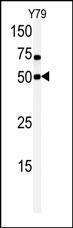 Anti-CLK1 Rabbit Polyclonal Antibody (HRP (Horseradish Peroxidase))