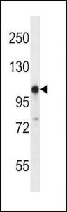 Anti-GRIK3 Rabbit Polyclonal Antibody (FITC (Fluorescein Isothiocyanate))