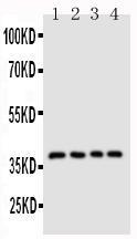 Anti-CD1d Rabbit Polyclonal Antibody