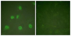 Immunofluorescence analysis of HeLa cells using Anti-Cullin 1 Antibody. The right hand panel represents a negative control, where the Antibody was pre-incubated with the immunising peptide