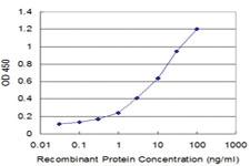 Anti-AURKB Mouse Monoclonal Antibody [clone: 5H7]