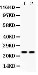 Anti-Mad2L1/Mad2 Polyclonal Antibody