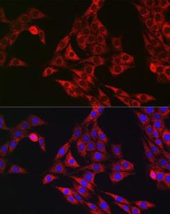 Immunofluorescence analysis of PC-12 cells using Anti-P4HB Antibody (A8454) at a dilution of 1:100 (40x lens). DAPI was used to stain the cell nuclei (blue)