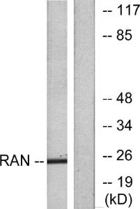 Western blot analysis of lysates from LOVO cells using Anti-RAN Antibody. The right hand lane represents a negative control, where the antibody is blocked by the immunising peptide