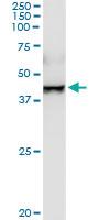 Anti-ERP44 Rabbit Polyclonal Antibody