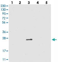 Anti-VSTM2A Rabbit Polyclonal Antibody