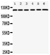 Anti-Coxsackie Adenovirus Receptor Rabbit Polyclonal Antibody