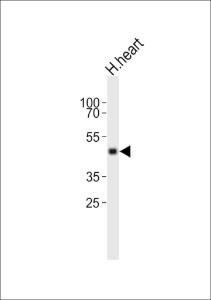 Anti-TIMM50 Rabbit Polyclonal Antibody