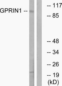 Western blot analysis of lysates from HT-29 cells using Anti-GPRIN1 Antibody. The right hand lane represents a negative control, where the Antibody is blocked by the immunising peptide