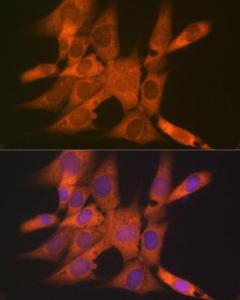 Anti-Tetranectin antibody