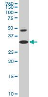 Anti-HOXD8 Mouse Monoclonal Antibody [clone: 5E11]