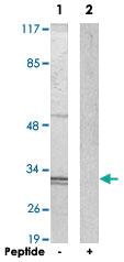 Anti-GTF2E2 Rabbit Polyclonal Antibody