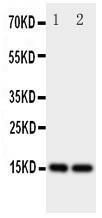 Anti-Fatty Acid Binding Protein 5 Rabbit Polyclonal Antibody