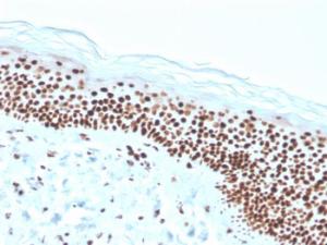 Immunohistochemical analysis of formalin-fixed, paraffin-embedded human skin using Anti-Nucleophosmin Antibody [rNPM1/1901]