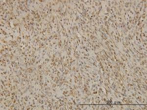 Anti-BUB1B Mouse Monoclonal Antibody [clone: 2G9]