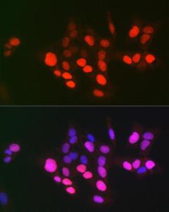 Immunofluorescence analysis of U-2 OS cells using Anti-Topoisomerase II alpha Antibody (A8458) at a dilution of 1:100 (40X lens). DAPI was used to stain the cell nuclei (blue)