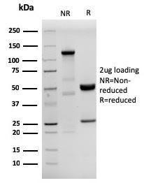 Anti-HHV8 LNA-1 antibody