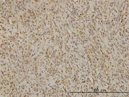 Anti-BUB1B Mouse Monoclonal Antibody [clone: 2G9]