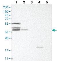 Anti-GOT1L1 Rabbit Polyclonal Antibody