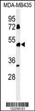 Anti-BTNL8 Rabbit Polyclonal Antibody