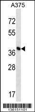 Anti-DPH1 Rabbit Polyclonal Antibody