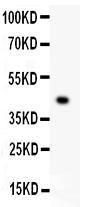 Anti-Mesothelin Polyclonal Antibody