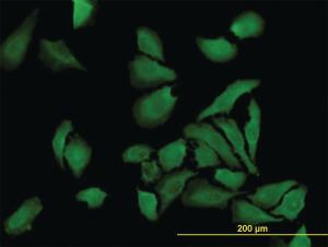 Anti-BUB1B Mouse Monoclonal Antibody [clone: 2G9]