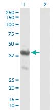 Anti-ENO1P1 Mouse Polyclonal Antibody