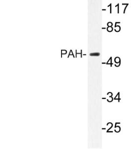 Western blot analysis of lysate from HepG2 cells using Anti-PAH Antibody