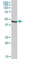 Anti-ENO1P1 Mouse Polyclonal Antibody