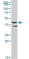 Anti-ERP44 Rabbit Polyclonal Antibody