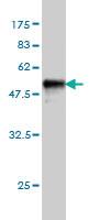 Anti-AK1 Mouse Monoclonal Antibody [clone: M2]