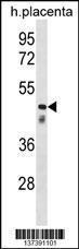 Anti-CLUL1 Rabbit Polyclonal Antibody