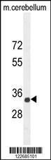 Anti-CADM1 Rabbit Polyclonal Antibody (HRP (Horseradish Peroxidase))