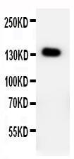 Anti-PTCH2 Rabbit Polyclonal Antibody