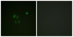 Immunofluorescence analysis of A549 cells using Anti-Chk1 Antibody. The right hand panel represents a negative control, where the antibody was pre-incubated with the immunising peptide