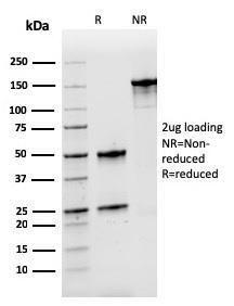 SDS-PAGE analysis of Anti-Nucleophosmin Antibody [rNPM1/1901] under non-reduced and reduced conditions; showing intact IgG and intact heavy and light chains, respectively. SDS-PAGE analysis confirms the integrity and purity of the antibody.