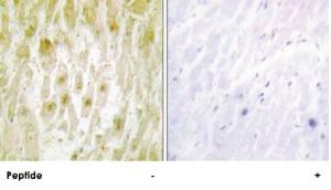 Anti-GTF2E2 Rabbit Polyclonal Antibody