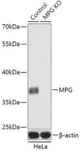 Western blot analysis of extracts from normal (control) and MPG knockout (KO) HeLa cells, using Anti-MPG / AAG Antibody (A92907) at 1:1,000 dilution. The secondary antibody was Goat Anti-Rabbit IgG H&L Antibody (HRP) at 1:10,000 dilution.