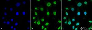 Immunocytochemistry/Immunofluorescence analysis of mouse myoblast cell line C2C12 , fixed in 4% formaldehyde for 15 min at room temperature, using Anti-TRAP1 Antibody [3H4-2H6] (A305019), at 1:100 for 60 minutes at room temperature