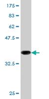 Anti-CD19 Mouse Monoclonal Antibody [clone: 1C9]