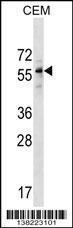 Anti-DPH2 Rabbit Polyclonal Antibody (AP (Alkaline Phosphatase))