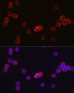 Immunofluorescence analysis of TF-1 cells using Anti-JAK3 Antibody (A8460) at a dilution of 1:50 (40x lens). DAPI was used to stain the cell nuclei (blue)