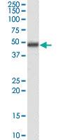 Anti-MBD2 Goat Polyclonal Antibody