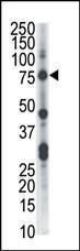 Anti-CLK2 Rabbit Polyclonal Antibody (FITC (Fluorescein))