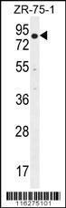 Anti-BTRC Rabbit Polyclonal Antibody (PE (Phycoerythrin))