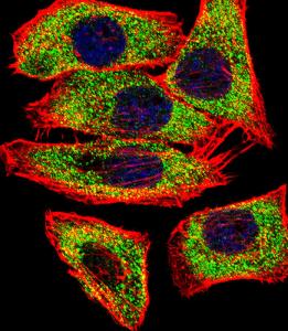 Anti-Transglutaminase Rabbit Polyclonal Antibody (HRP (Horseradish Peroxidase))