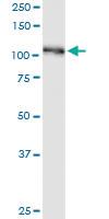 Anti-BUB1B Mouse Monoclonal Antibody [clone: 2G9]