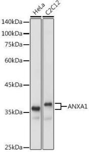 Anti-Annexin A1/ANXA1 antibody