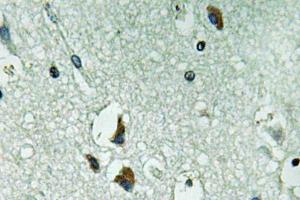 Immunohistochemical analysis of paraffin-embedded human brain tissue using Anti-PAH Antibody